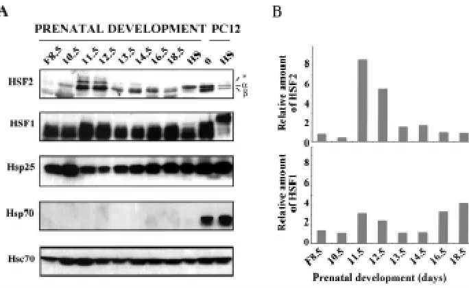 Fig. 4. Analysis of HSE-bind-ing activity in the develop-FREE indicates unbound HSE oligonucleotide