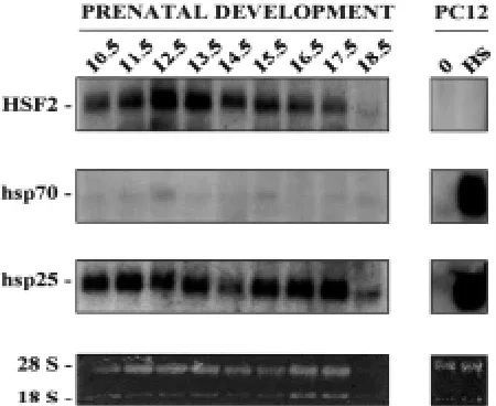 Fig. 6. Expression of HSF2 mRNA during heart development. Total