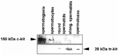 Fig. 2. Western blot analysis of equal amounts of protein extracts frompurified male germ cell populations obtained from mouse post-natal testisat different stages of differentiation, probed with a polyclonal antibodydirected against the 13 carboxy-terminal amino acids encoded by themouse c-kit open reading frame.