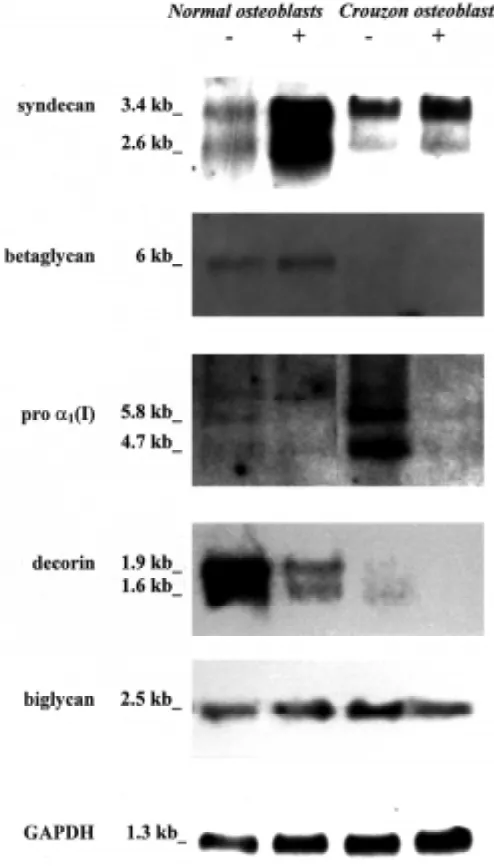 Fig. 7. were analysed using the Northern hybridisation technique. The same filterwas stripped and re-hybridised with [Expression of syndecan, betaglycan, type I procollagen, decorin,biglycan and glyceraldehyde-3-phosphate dehydrogenase (GAPDH)in human norm