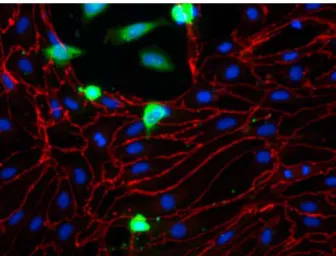 Figure 3:  A2058 melanoma cells (green) in contact with brain endothe- endothe-lial cells (red: ZO-1 staining).