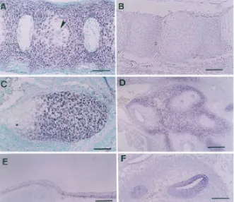 Fig. 5. In situ hybridization for ChM-I transcripts in mouse embryos at various developmentalstages