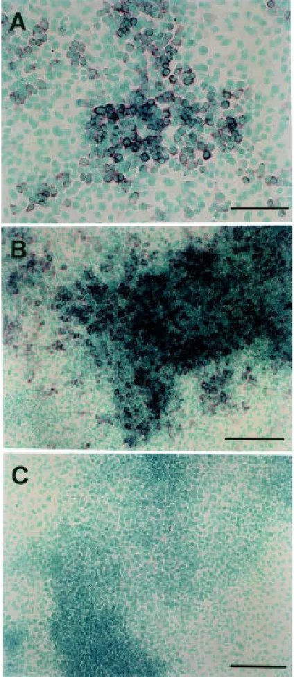 Fig. 7. Bars, 100 probe for ChM-I. The nuclei of the cells were stained with methyl green.with a digoxigenin-labeled antisense cRNA (A and B) or sense cRNA (C)cells were plated in a two-well Lab-Tek Chamber Slide at a density of 2x10described in the Fig