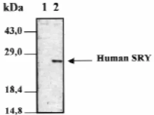 Fig. 1. Western blotting on Hela 7A and HeLa SRYB3 cells. Totalextracts were prepared as described in Material and Methods