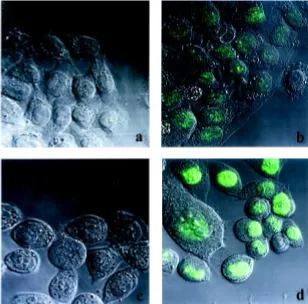 Fig. 2. Cellular localization of SRY protein. Immunochemical analysis was done inHeLa 7A and HeLa SRYB3 cells fixed and permeabilized, and then stained with