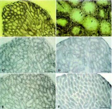 Fig. 8. Localization of Sip proteins by in situ farwestern blotting., as demonstrated by subsequentimmunostaining of the corresponding imprints with antibodies against either enlargement of a subsection (boxed) in A showed staining of putative Sertoli cell