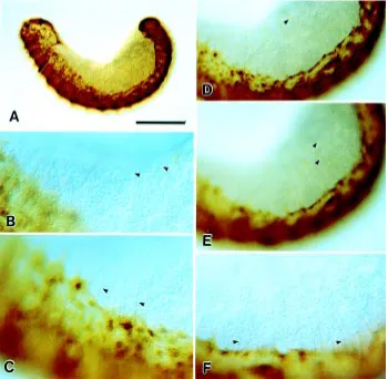 Fig. 4. Dorsal expansion of the mesodermal GB is preceded by elongation of circumferential