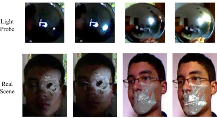 Fig. 8. Photorealistic on-patient medical data visualization based on local illumination components.