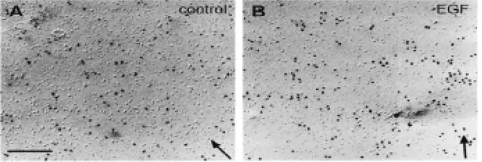 Fig. 2. Rapid EGF-induced receptor clustering. Human A431 cells were immunogold labelled,using anti-EGFR MAb 2E9, and freeze-fractured