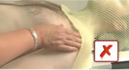Fig. 3. Good immobilisation of forehead, nose and chin.