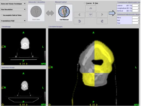 Fig. 6. MVCT imaging and co-registration.