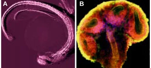 Fig. 4. Examples of visualisation and (complex) patterns of geneexpression using confocal image data