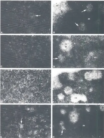 Fig. 2. Higher, magnificationphotographsunderdarkfieldshowingtheexpressionof the5'HoxDgenesto bettervisualizethe twodifferentpatternsof expression.IA,B) Ho~D9
