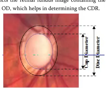 Figure 2. Optic Cup-to-Disc Ratio 