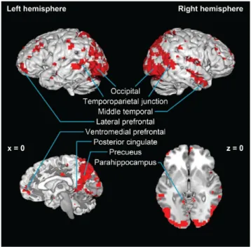 Figure 2.5 Voxels selected from six contrasts using 1% threshold in each direction, covering  several areas associated with episodic memory, self-awareness and the default network 