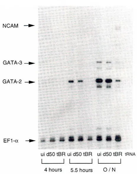 Fig. 2. Expression ofGATA.2and 3 in nonneuralanimal pole of all four bfastomeresectodermis depend.ent on BMP-4 signaling.lng of a dominantnegativetruncated8MPreceptor RNA (lanes tBR) or of a control RNA fd5OJ