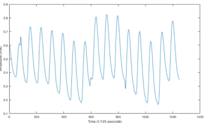 Figure 2 Typical of PPG signal (10 seconds duration)  2.2 Ensemble Empirical Mode Decomposition (EEMD) 