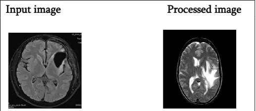 Figure 7. Sample Dataset (V transform algorithm). Figure 7 is the input and the processed enhanced image using the V transform algorithm