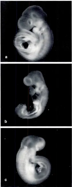 Fig. 1. Effect of EGFon growthsera of rat embryosculturedin depleted in vitro. Conceptuses were e\planred on gesrarional day 9 andcultured in serumwhich had beensubjectedto ultrafiltration to remove