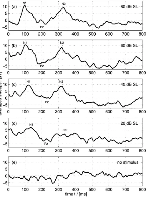 Fig. 1.EEG averages over 100 sweeps obtained from a single individual:(a)–(d) variable stimulation intensities of 80, 60, 40, and 20 dB above hearingthreshold (SL) applied at t = 0 containing CAEP; (e) no stimulation (�1 dB)and, hence, no CAEP.