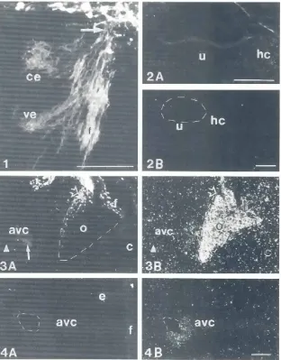 Fig. 1. TDA tracingof facial motorneuronsand oticefferents.Eplfluorescenceimage of a sectionsubjectedto in situ hvbridlzatlon analvsis using a BDNF probe afrerTDA filhng of efferents.Fibers efferentto the brain suchas the branchlal- and visceral motorfiber