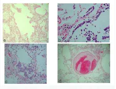 Fig. 1.alveolar ducts and sacs (H&E, x100) b) Type II pneumocytes hyperplasia c) Type II  Diffuse alveolar damage triad