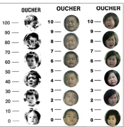 Fig 2. Oucher Scale: Left is U.S. version ( Liebelt, 2000)；Middle is Taiwan version of the boys，Right is Taiwan version of the girls ( Yeh, 2005) 