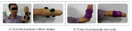 Figure 1. Note that comparative anode design and 