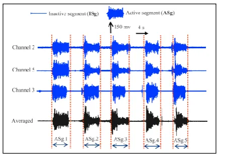 Figure 4. Active segments of EMG signals from 