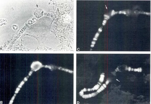 Fig. 3. Salivary gland chromosomesmosomeof Glyptotendipesbardipes.(A-C)Part of a metacentric chromosome