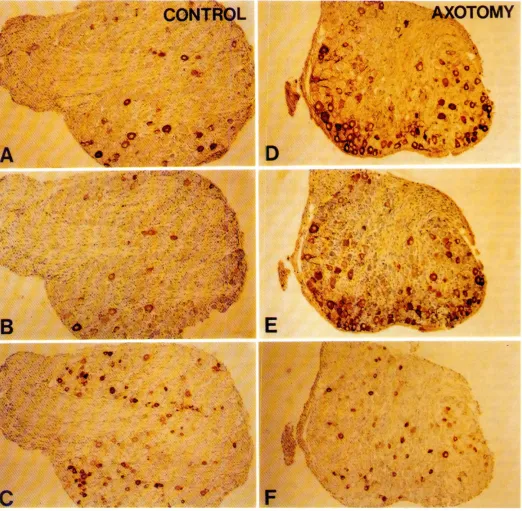 Fig. 3. L5 DRG 7 dayscafter axotomyof the sciaticnerveat postnatalday 2. (A,B,C) Contralateral control side; (D,E.F) ipsifaterallesionedside;consecutive sections are stamed with anti-FGF-2(A.D),anti-FGFR IS,E}, andanci-CGRP(C,F),FGF-2andFGFR are largely co