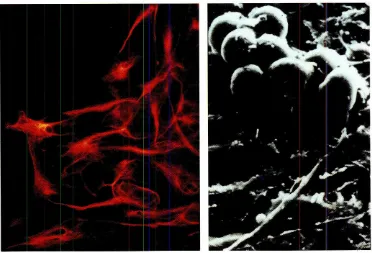 Fig. 2. The twomainneurallineagesemergefrom competentectodermin.ducedbydissociation.(left)Astrogliocytes(GFAp positive).(Right)Neuronsvisualized by scanningelectronmicroscopy.These cells are positiveforneuronal markers(NC1, NF etc.).