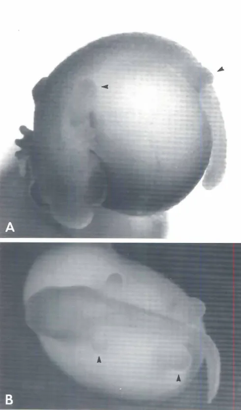 Fig. 7. Direct-developingembryos.(AI The Mexicanplethodonridsala-manderChiropterotritonmagnipes("early pigmentation'stage:Vial,1968.Fig