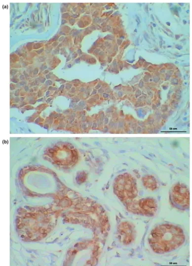 Figure 1. Immunohistochemical staining for (a) mcl-1 and (b) bcl-2 protein expression