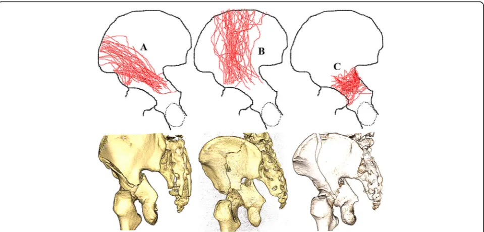 Fig. 4 Maps of three major fracture lines marked with a, b and c. Representative three-dimensional computed tomography images of eachgroup are presented for illustrative purposes