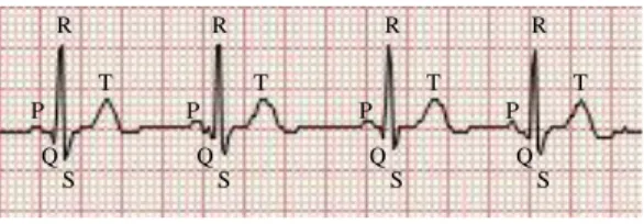 Figure 3.1: The interval between consecutive R waves determines the heart rate.