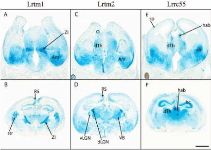 Figure 9Expression of Elron cluster genes in developing mouse brainD, F). Differential staining in subsets of thalamic nuclei and across cortex is observed