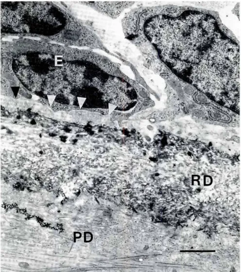 Fig. 3. TEM of coronalpredentin(PDJ from one day old murinefirstmolar.Note rhe denser predentin matrix than rhat seen in rhe root