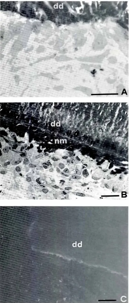 Fig. 5. Histological micrographs of pulp tissue responsesplantationinpolar patternpolyclonaf to im.of demineralizeddentin IddJ for 3 {AI or 7 IBI or 6 ICIdays intrapulpal sites of dog teeth