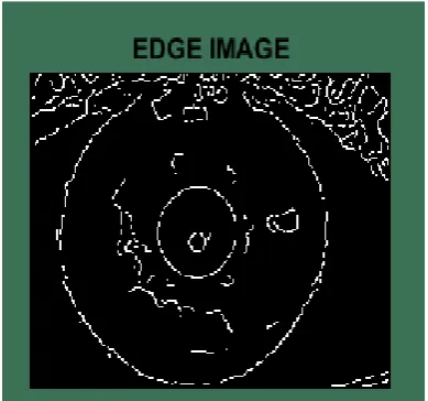 Figure 7. Feature Extraction 