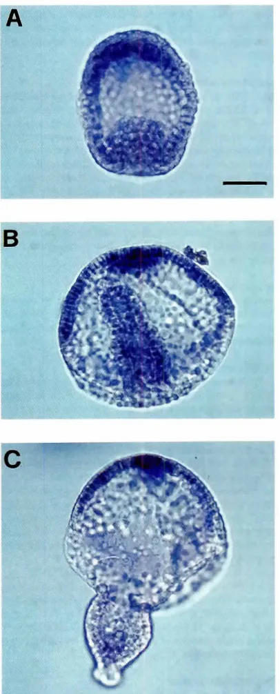 Fig. 6 Expression-Zn++. or phenytoin-pattern of Pla2 in Paracentrotuslividusembryostreated.The whofe-mountin situ hybridizationsare performedas in Fig