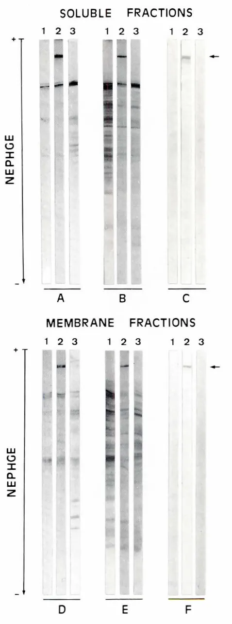Fig. 3. Western-blotsand pineal organgivenfromNEPHGE.Analysisof sofubleandmembranefractions from cerebral hemispheres(lane1), sca!lane 21 (lane 3)