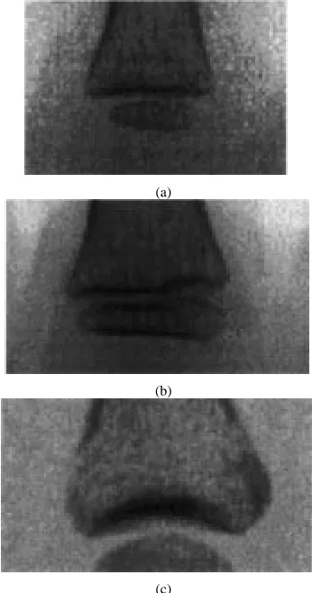 Fig. 7.Proximal part of the proximal phalanx for: (a) 4-, (b) 8-, and (c) 16-yr-old growth stages.