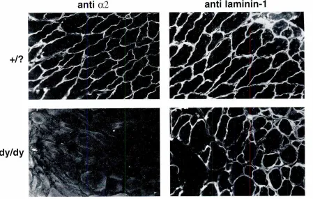 Fig. 1. Detectionof lamininin skeletalmusclefromnormaland dystrophicdy mice by indirectimmunofluorescence.Lammin-2 cannot bedetected in muscle of homozygous dy/dy mice when using antibodies specific for the laminin a2 chain