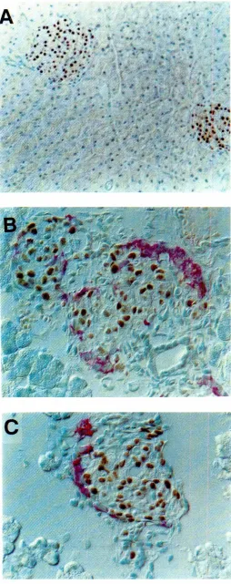 Fig. 4. IPF1affinity purified anti-IPF1 antibodiesis restrictedtotheB.-cells of adult mouse pancreas.Cryostat sections(8 urn) from adult mousepancreaswere stainedwithand anti-islet hormoneantibodies.(A) Staining (dark brown) with anti.fPF1 antisera showing