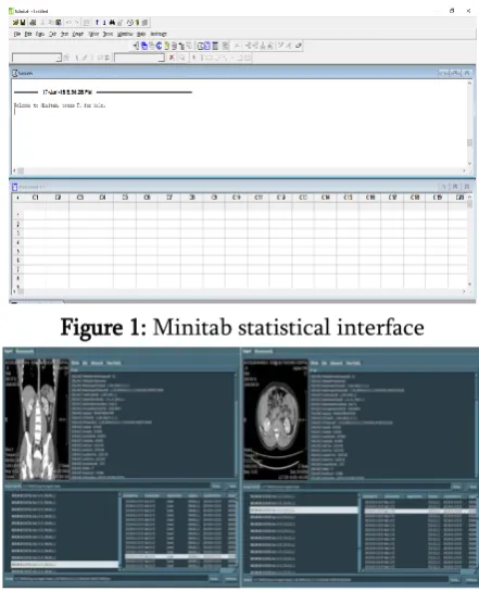 Figure 1: Minitab statistical interface 