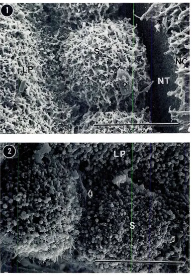 Fig. 2, SEM showingativelyuniformsize