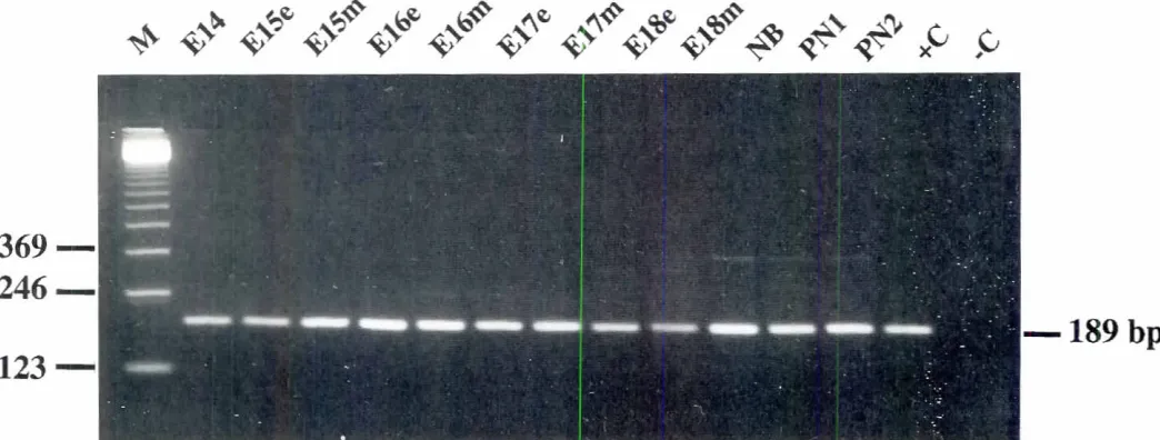 Fig. ,. RT-PCR amplificationof PDGFA mRNA 1189 bp) isolatedfromenamelorganepithelia(e) or dentalmesenchyme1m) of E15 throughPN2 mousemandibularfirst molars.The enrire toorh germwas used !:om £14 embryo.The ilrst lane (marked M) is the 123 bp DNA ladder (GI