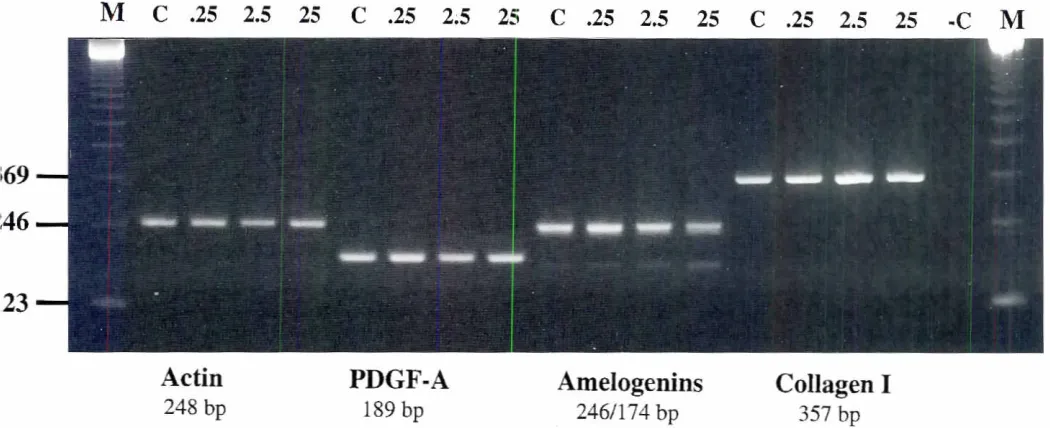 Fig. 4. RT-PCRamplification of dental matrix protein transcriptsfromcentrationPDGF treatedmousemandibularfirstandsecondmolarex plantsIE15+7dc).Lanes M: the 123 bp DNA marker bands; lanes C:control; lanes .25: PDGF.AA at concentrationof 0.25 ng/m/; lanes 2.