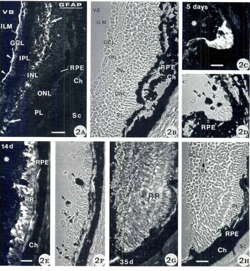 Fig. 2. GFAP labelingin normalmentedand regeneratingretinaeof adultnewt.!A-B) Part of radial sectionthrough unoperatedretina